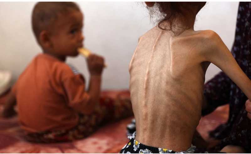 نفاد الحطب يفاقم معاناة أهالي قطاع غزة.