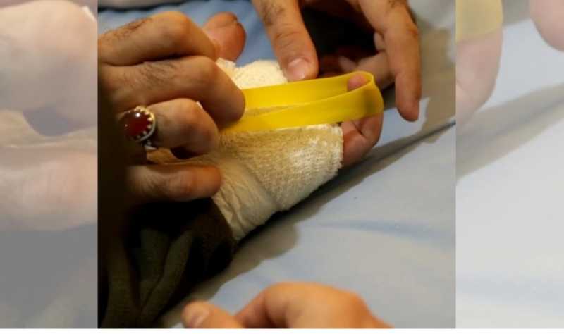 مؤسسة الجرحى» 12 مشروعاً لمساعدة المصابين