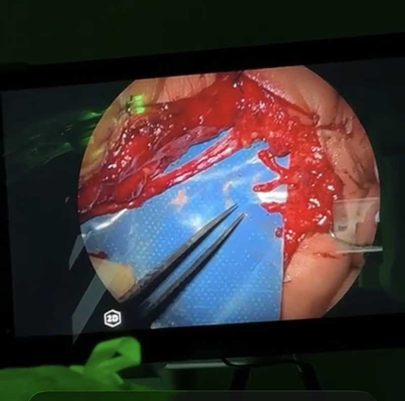 هام  من لبنان إلى المعايير العالمية مركز لبنان الطبي – الحدت يوقّع إنجازًا جراحيًا استثنائيًا